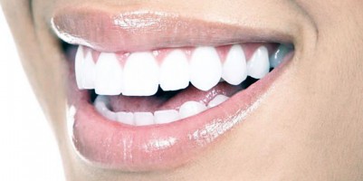 Natuurlijke oplossingen voor witte tanden